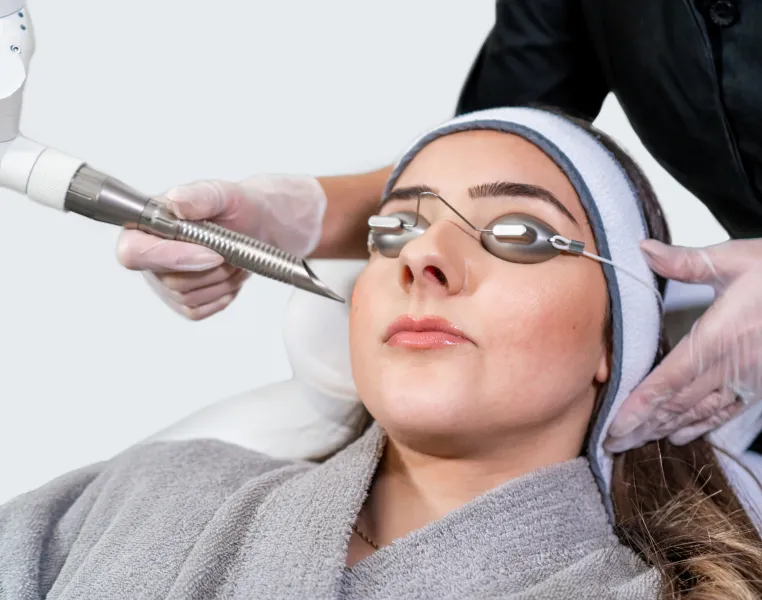 Laser toning skin brightening treatment at Lavish Aesthetique Clinic, Satellite, Ahmedabad